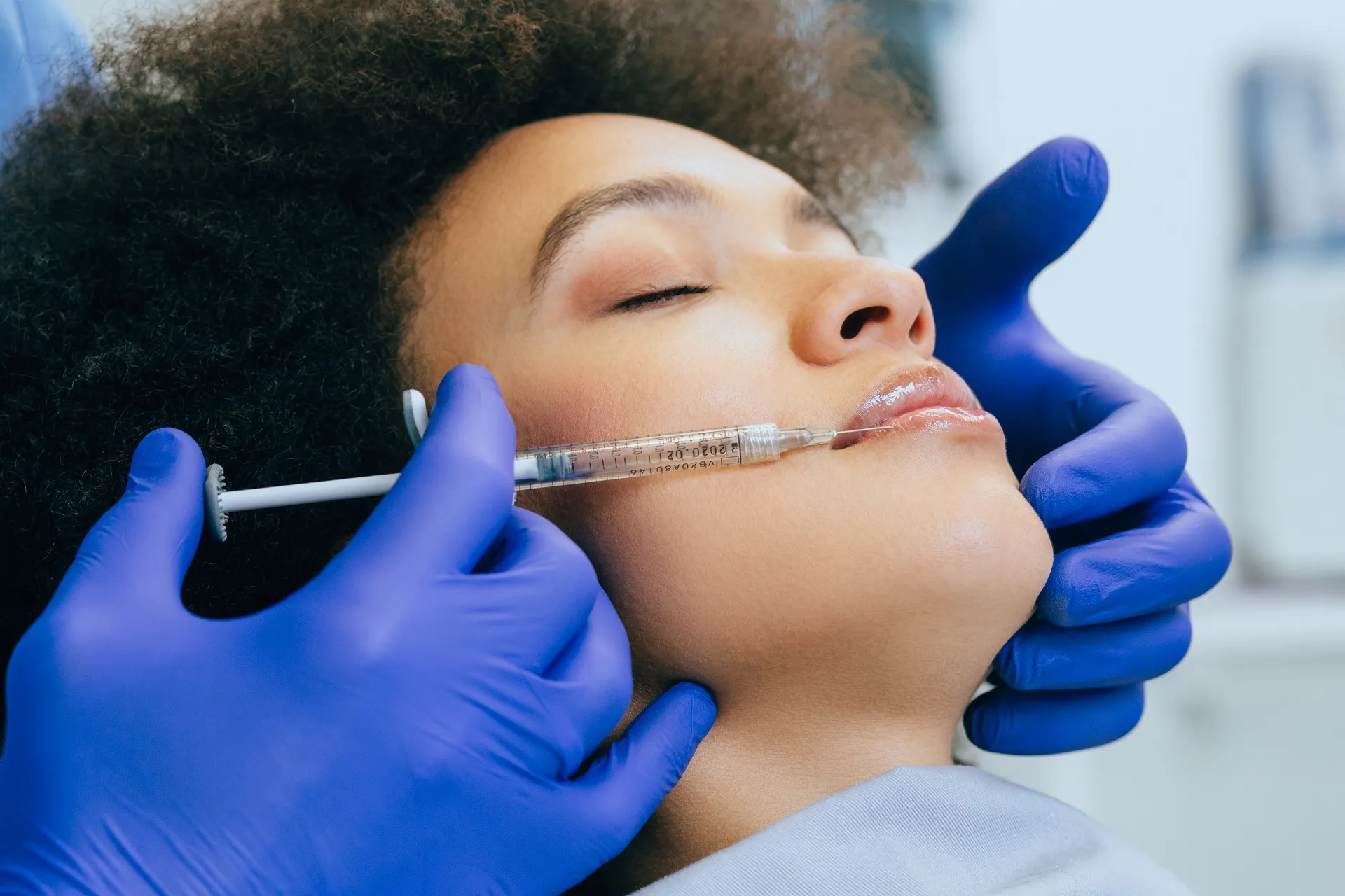 Dermal Fillers in Pompano Beach, FL by Essential Aesthetics