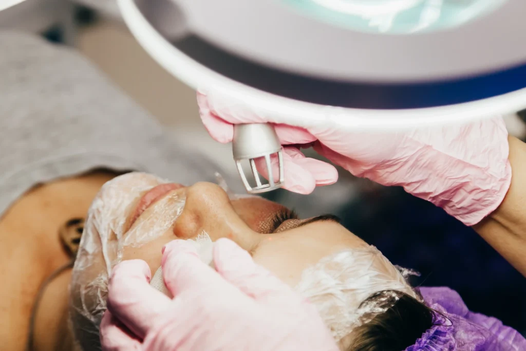 CO₂ Laser Plus Facial treatment being performed on a woman's face with protective gel applied, at Essential Aesthetics & Health in Fort Lauderdale, FL.