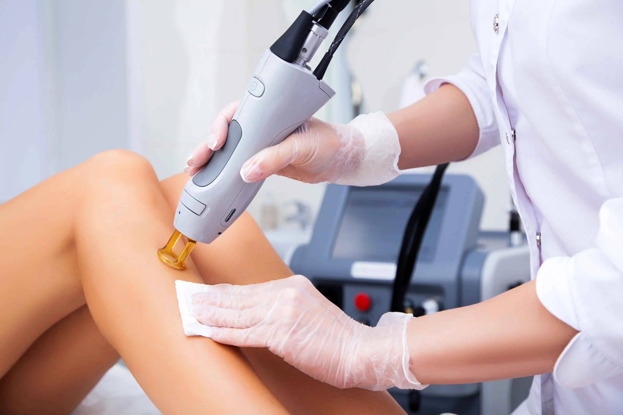 Laser Treatments